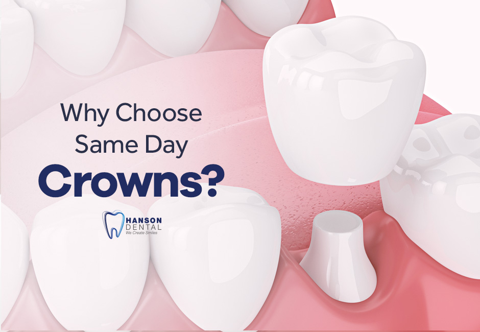 Why Choose Same Day Crowns?