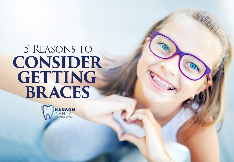 5 Reasons to Consider Getting Braces