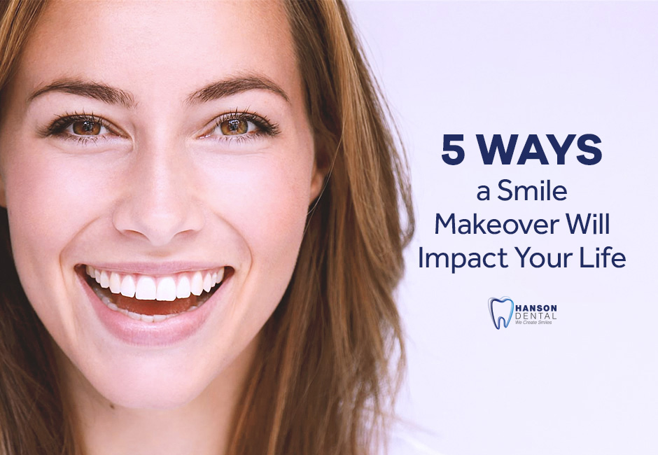 5 Ways a Smile Makeover Will Impact Your Life