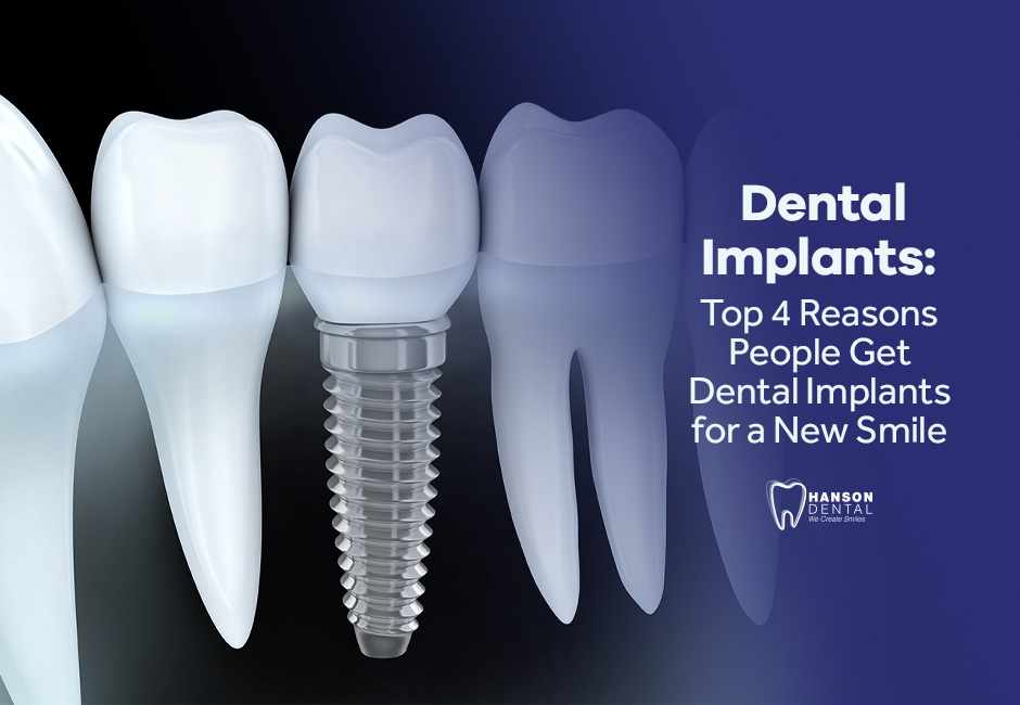 Dental Implants: Top 4 Reasons People Get Dental Implants for a New Smile