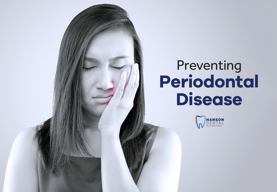 Preventing Periodontal Disease