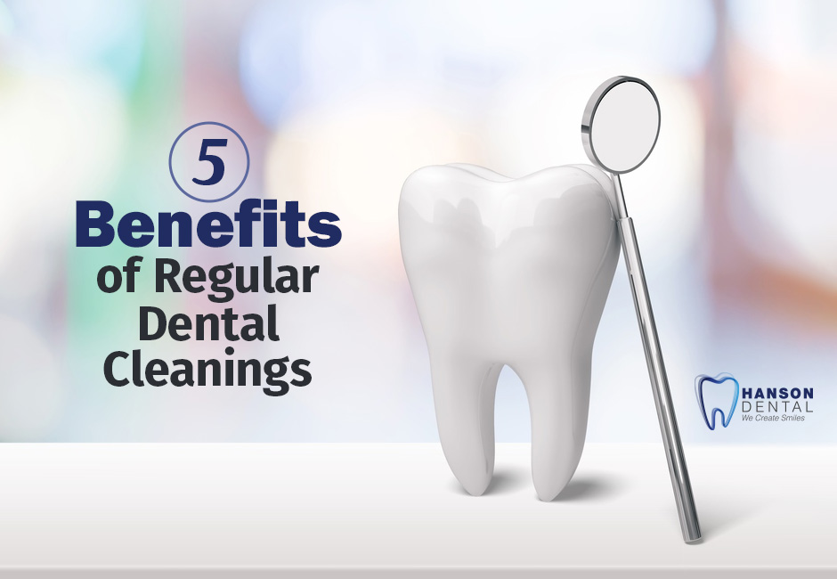 5 Benefits of Regular Dental Cleanings