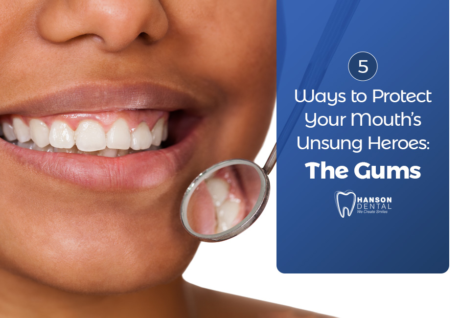 5  Ways to Protect Your Mouth’s Unsung Heroes: The Gums