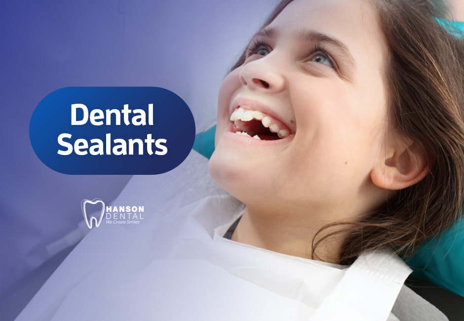 Dental Sealants