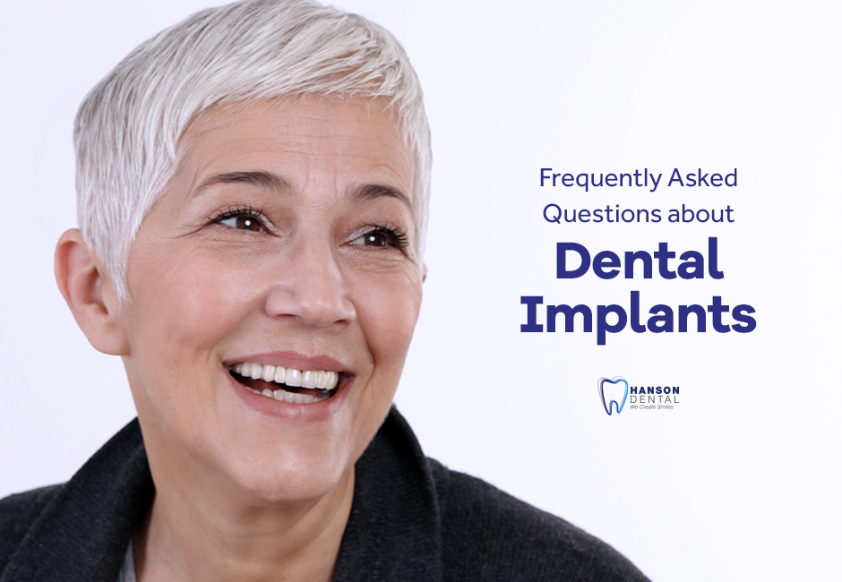 Frequently Asked Questions about Dental Implants